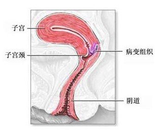 习惯性流产检查项目到底有哪些呢