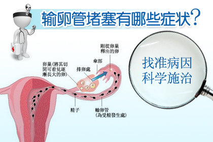 引起女性输卵管堵塞的原因有什么